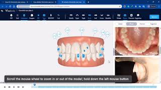 how to effectively review the 3D treatment scheme 1 [upl. by Neo]