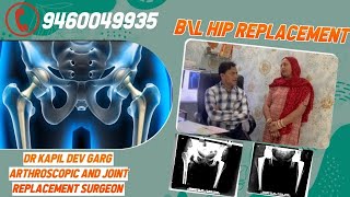 कैसा लगता है हिप रिप्लेसमेंट के 3साल बाद   Hip Replacement Karvan Shi h Ya Galt  hipreplacement [upl. by Aurel402]