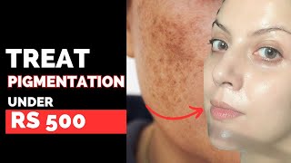 The 5 Best Products To Treat Pigmentation Under Rs 500  Nipun Kapur [upl. by Kcirded582]