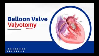 IM Cardiology 10 Valvular Heart Diseases Mitral Stenosis MS Treatment [upl. by Akapol]