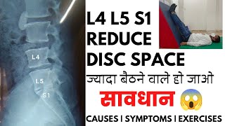 L4L5 and L5S1 reduced disc space exercises in Hindi  Disc space narrowing L5S1 treatment [upl. by Eudocia825]