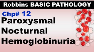 Ch12  Paroxysmal Nocturnal Hemoglobinuria  Blood Pathology  Dr Asif Lectures [upl. by Alihet]