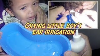 Crying Little Boys Ear Irrigation [upl. by Naivart]