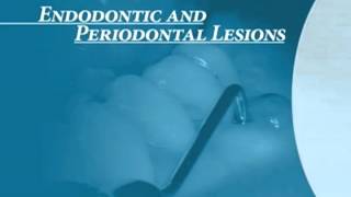 Endodontics Torabinejad 60 Endo Perio Introduction [upl. by Wendelin]