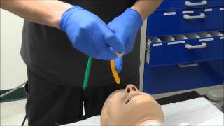 Nasal Intubation [upl. by Eeryk]