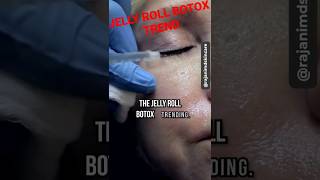 JELLY ROLL BOTOX TREND [upl. by Ereynihc]