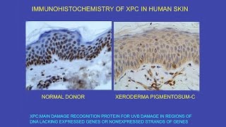 CARTA Unique Features of Human Skin – Ultraviolet Radiation Effects on DNA and Carcinogenesis [upl. by Meeki]