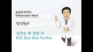 심전도 한 걸음 더 35 삼섬유속 차단 Trifascicular block [upl. by Uno]