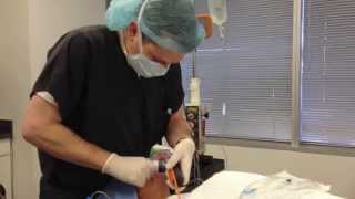 Quick amp Easy Bougie Port Intubation [upl. by Nedlog805]