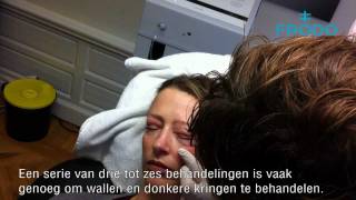 Behandeling Wallen en donkere kringen rond de ogen verbeteren met Carboxytherapie [upl. by Sibel163]