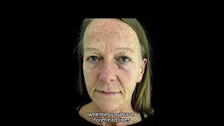 Anti wrinkle cream check comments [upl. by Nbi761]