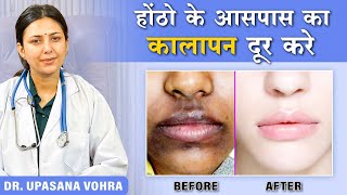 How to Remove Pigmentation Around the Mouth Upasana Ki Duniya [upl. by Olivero801]