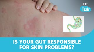 How Your Gut Health Impacts Skin and Stomach  Unlocking the Connection  Doc Talk  Fit Tak [upl. by Kram558]