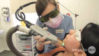 Laser Hair Removal  How does it work [upl. by Mcintosh]