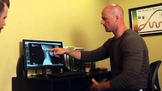 Chiropractic Assesment XRay and Spinal Adjustment On Hip amp Rotator Cuff Patient [upl. by Aloeda]