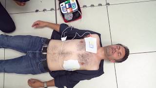 Using a defibrillator [upl. by Ollayos]