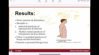 Brachial plexus injury [upl. by Alleul]