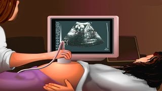 How Ultrasound Works Animation  Ultrasound Scan During Pregnancy Video  USG Medical Imaging [upl. by Romona]