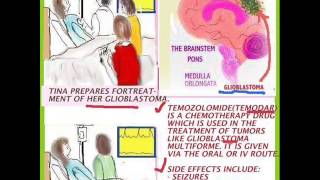 THE NEW NURSE  CHEMOTHERAPY AND BONE MARROW TRANSPLANT [upl. by Dell]