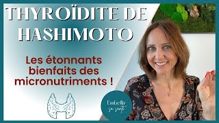 Hypothyroïdie d’Hashimoto régime alimentaire et solutions naturelles [upl. by Nwahsyt435]