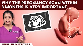 Why the pregnancy scan within 3 months is very important  கர்ப்ப காலத்தில் CRL அளவீடு முக்கியமா [upl. by Anastassia]