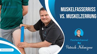 Muskelfasserriss VS Muskelzerrung – Wie Du es erkennst und unterscheiden kannst [upl. by Stringer]