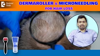 AT HOME Microneedling amp Dermaroller for HAIR LOSS Explained by  DrRajdeep Mysore Doctors Circle [upl. by Macguiness]