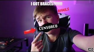 I Got Braces at The Orthodontist THIS IS BAD [upl. by Nek]