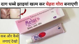 Melas Alfa Cream Review  melas alfa cream kaise use kare [upl. by Leanor]