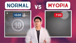 MYOPIA vs normal vision POV [upl. by Anitahs]