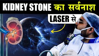 Kidney Stone Laser Surgery  VLOG [upl. by Nea]