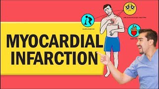 Myocardial Infarction Heart Attack for Nursing amp NCLEX [upl. by Wiener]