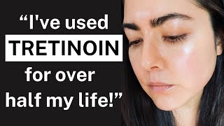 My 22YEAR Tretinoin Experience The Key to Youthful Skin for Over 2 Decades [upl. by Broida]