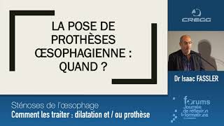 Dr FASSLER  Sténoses de l’oesophage  comment les traiter dilatation etou prothèse [upl. by Rasec]