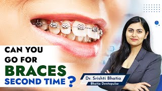 Can you Get BRACES a SECOND Time Dr Srishti Bhatia braces bracessmile smilemakeover [upl. by Aleb11]