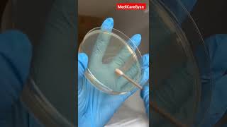 Bacteria Test bacteria bacteriologia test sponge microbiology microscopy viralshorts trend [upl. by Elkin350]