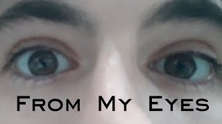 From My Eyes Conerod dystrophy Documentary [upl. by Ayahsey]