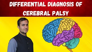 Cerebral palsy approach and differential diagnosis [upl. by Airol895]