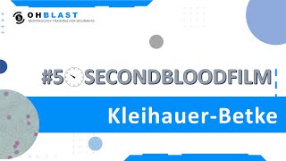 50SecondBloodFilm​ KleihauerBetke test [upl. by Kynan]