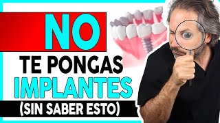 👉¿Que 𝗗𝗘𝗕𝗢 𝗦𝗔𝗕𝗘𝗥 del proceso de colocación de 𝗜𝗠𝗣𝗟𝗔𝗡𝗧𝗘𝗦 𝗗𝗘𝗡𝗧𝗔𝗟𝗘𝗦 para elegir a el DENTISTA ADECUADO [upl. by Archibold929]