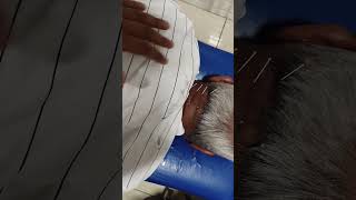 dryneedling neck pain [upl. by Phillips207]