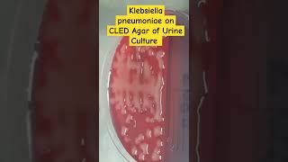 Klebsiella pneumoniae colony morphology on CLED of Urine Culture [upl. by Zeiger]