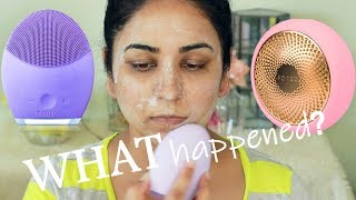 I used FOREO for 7 DAYS and this is what happened… [upl. by Racso]