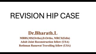 Revision hip case  management amp discussion [upl. by Stovall997]