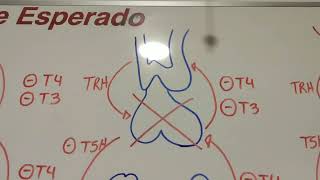 Resumen Fisiopatología Hipotiroidismohipertiroidismo [upl. by Ahsatsana318]