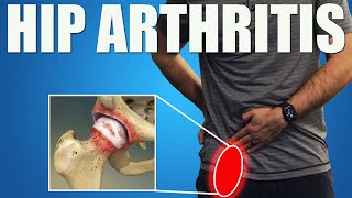 HIP OSTEOARTHRITIS BEST Exercises Stretches amp Advice for Hip amp Groin Pain Relief [upl. by Joshuah]