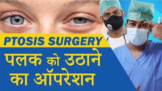 Ptosis Treatment  Droopy Eyelid Treatment  Oculoplastic Surgery for Ptosis at Eye7 Eye Hospitals [upl. by Ailen]