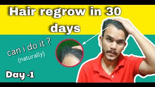 hair regrow in 30 days  can i regrow my hair line naturally in 30 days   preventing hair fall [upl. by Accalia969]