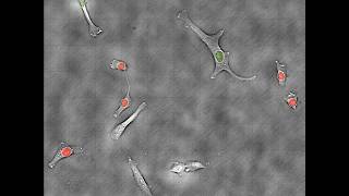 Human HT1080 Fibrosarcoma Cells on Etaluma LS600 [upl. by Attenat]