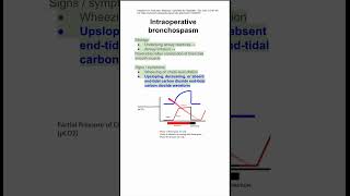 Intraoperative bronchospasm [upl. by Koal310]